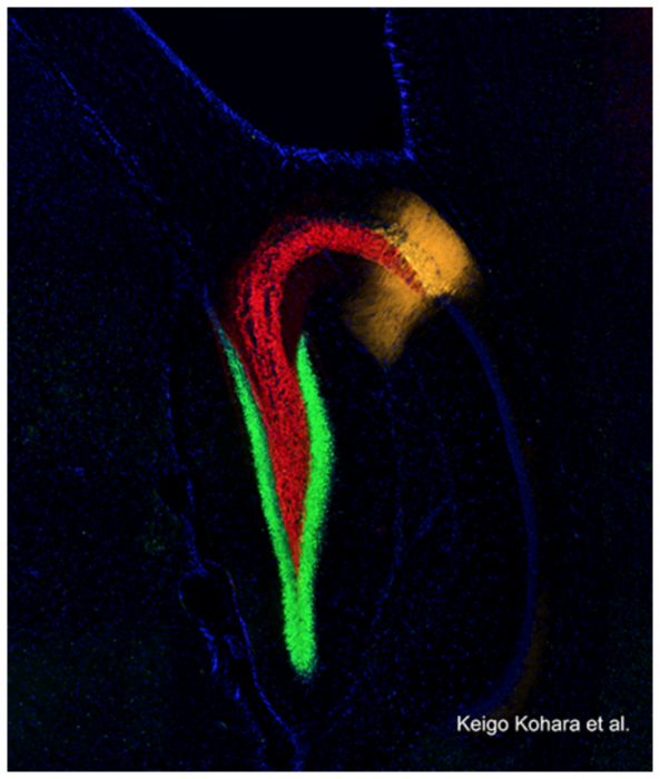 催眠療法と脳科学22